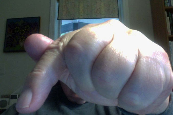 A selfie of my finger poised for action. "Too weird," Peggy says.